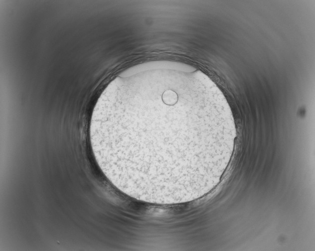 X0000116370174201001131755