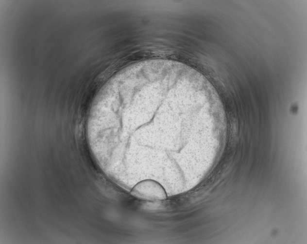 X0000116370177201001131755