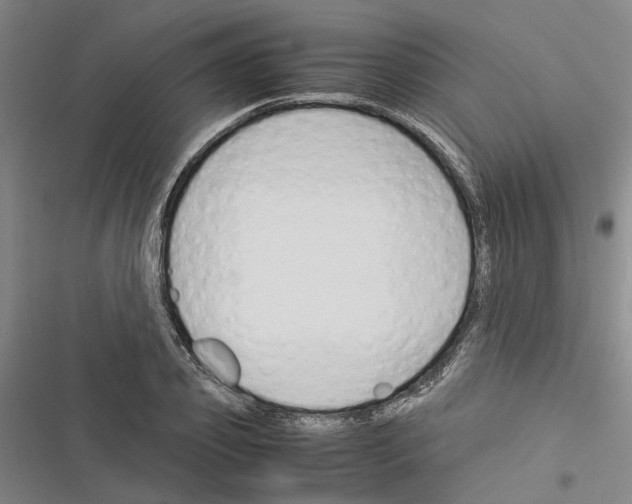 X0000116370933201001131744