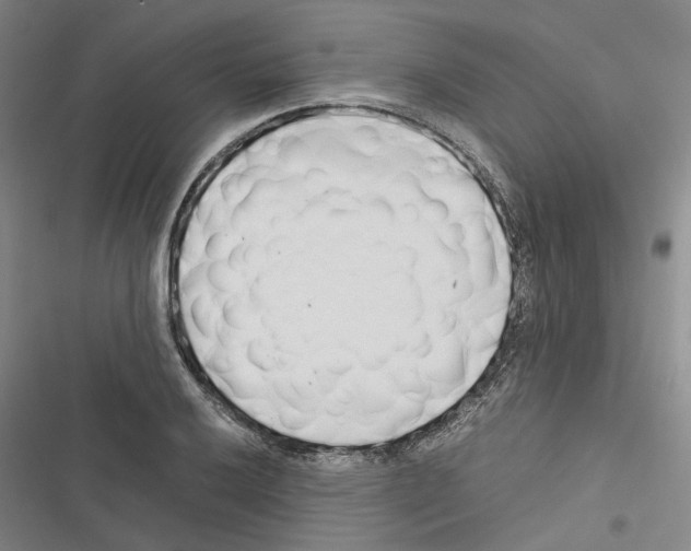 X0000116371032201001131743