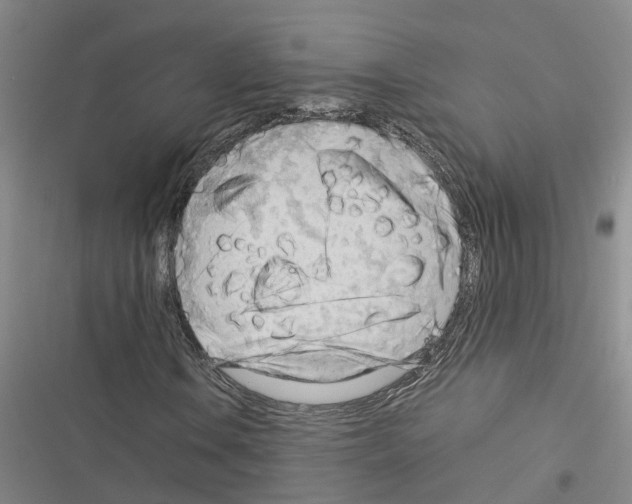 X0000116371106201001131741