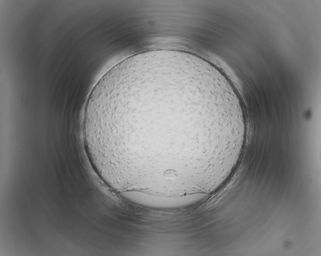 X0000116371386201001131738