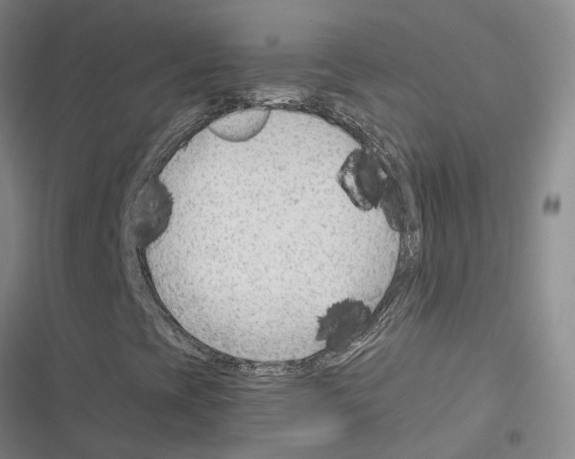 X0000116371393201001131738