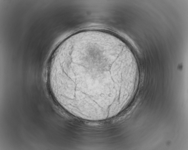 X0000116371413201001131738