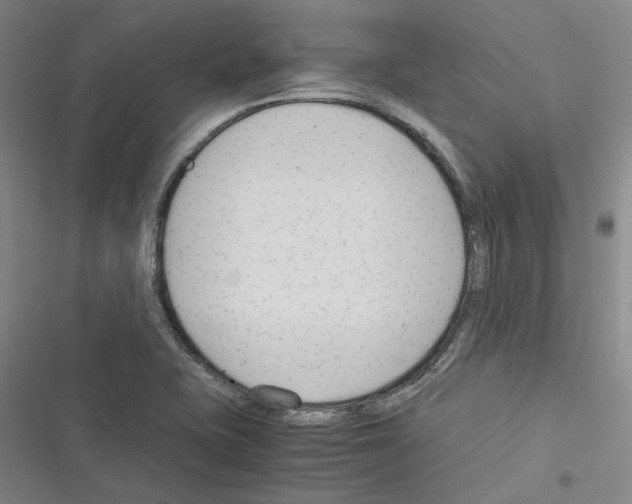 X0000116371415201001131738