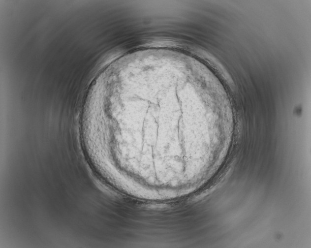 X0000116371425201001131738