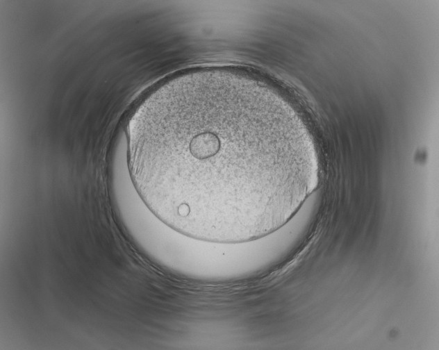 X0000116371457201001131737