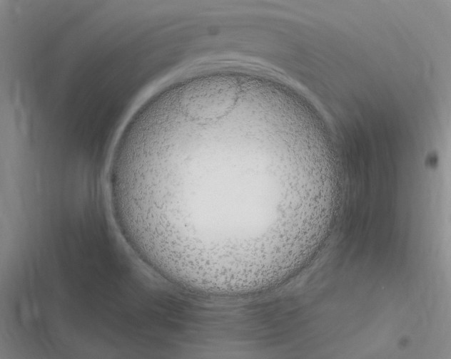 X0000116371514201001131737