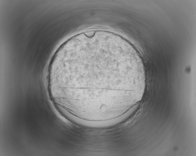 X0000116371519201001131737