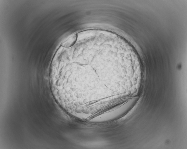 X0000116371529201001131737