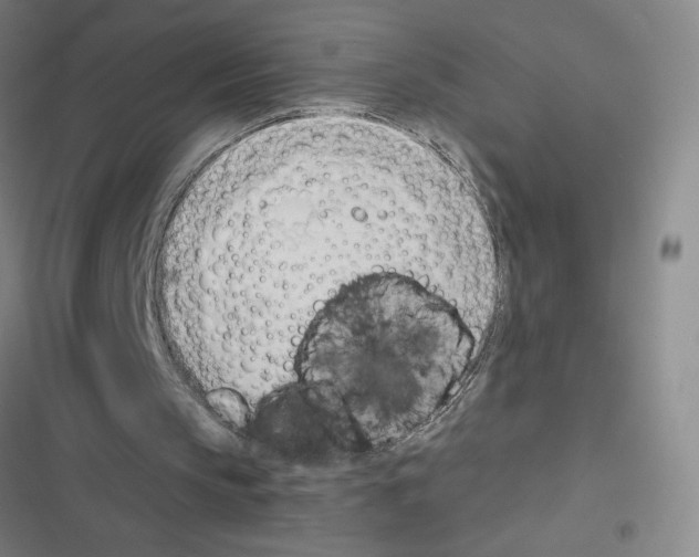 X0000116380145201001131815