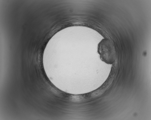 X0000116380277201001131815