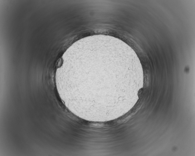 X0000116380575201001131811