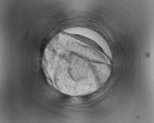 X0000116390328201001131835