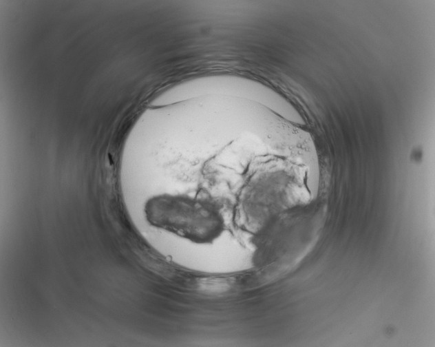 X0000116390373201001131835
