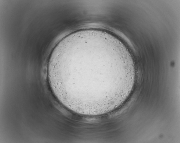 X0000116391413201001131820