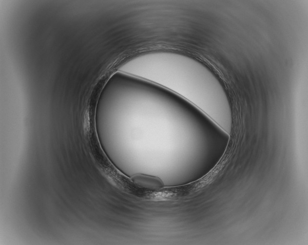X0000116420158200912081207