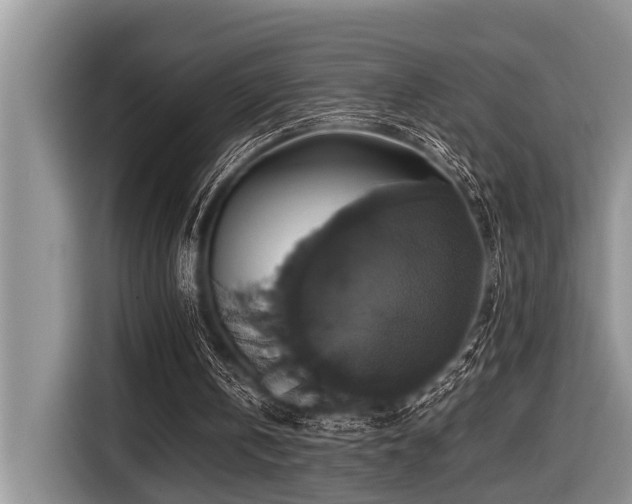 X0000116420146200912081511