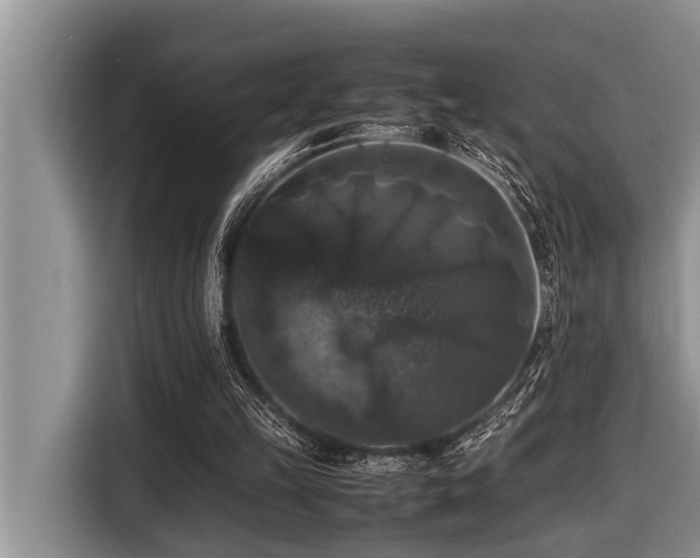 X0000116420149200912081511