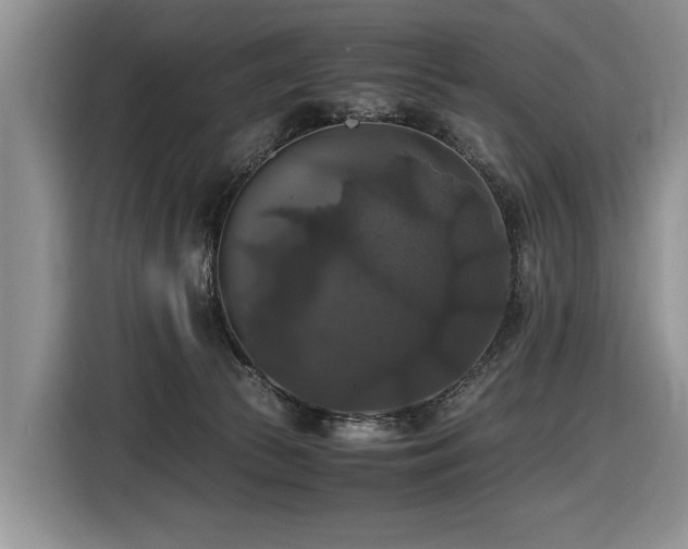 X0000116420177200912081511