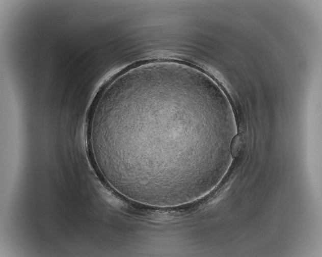 X0000116420987200912081500