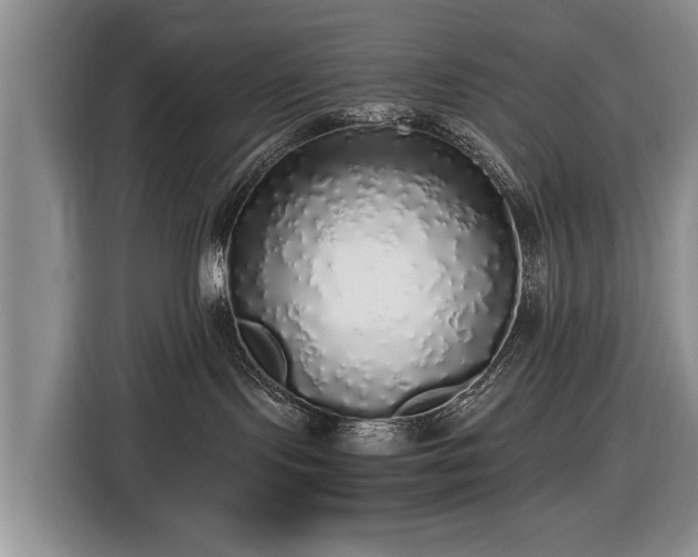 X0000116420095200912151007