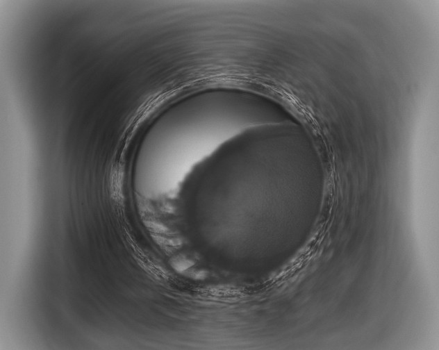 X0000116420146200912151005