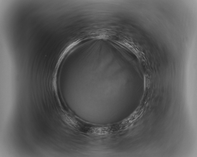 X0000116420147200912151005