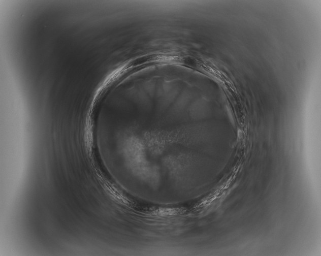 X0000116420149200912151005