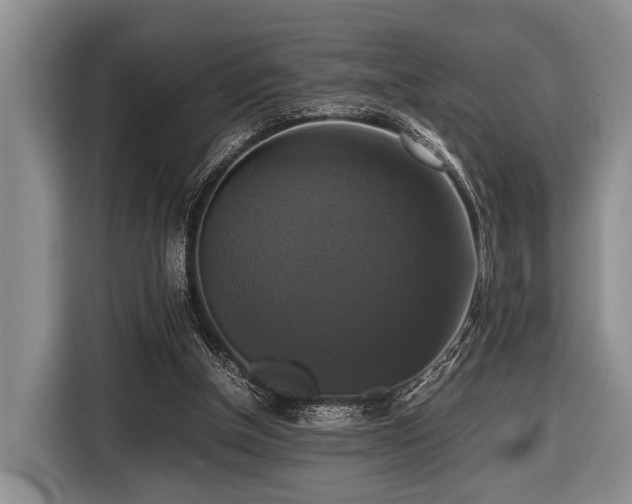 X0000116420154200912151005