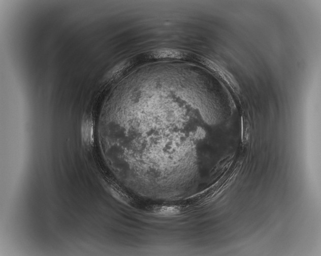 X0000116420157200912151005