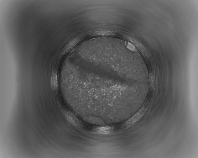 X0000116420158200912151005