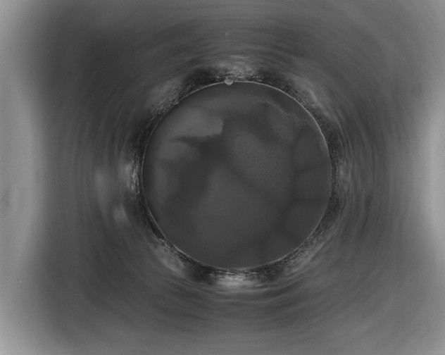 X0000116420177200912151005