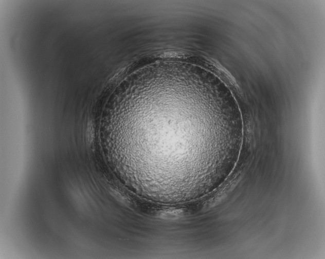 X0000116420257200912151004