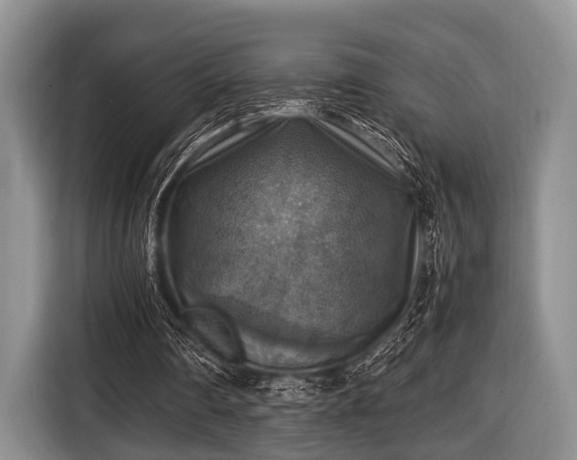 X0000116420290200912151004