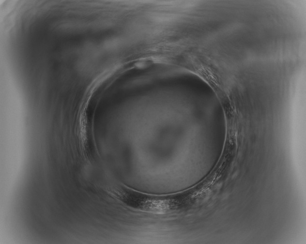 X0000116420295200912151004