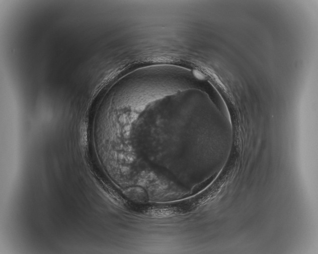 X0000116420299200912151003