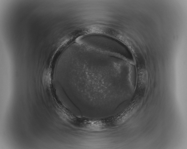 X0000116420395200912151002