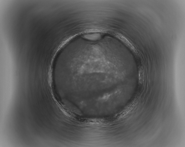 X0000116420436200912151001