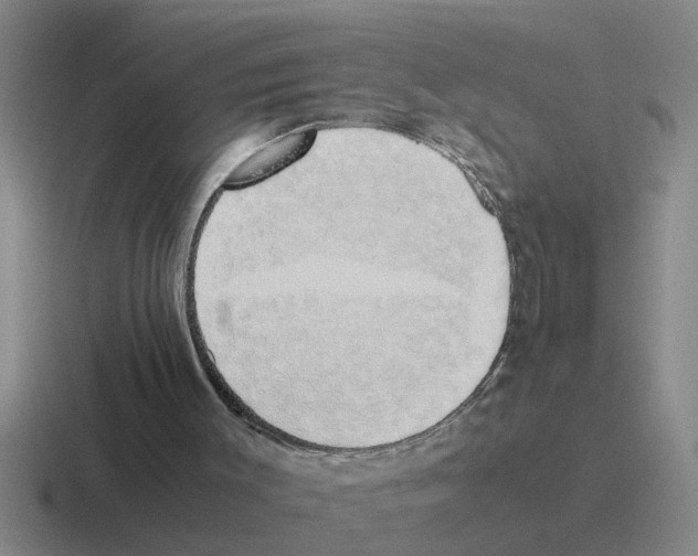 X0000116420003201001051135