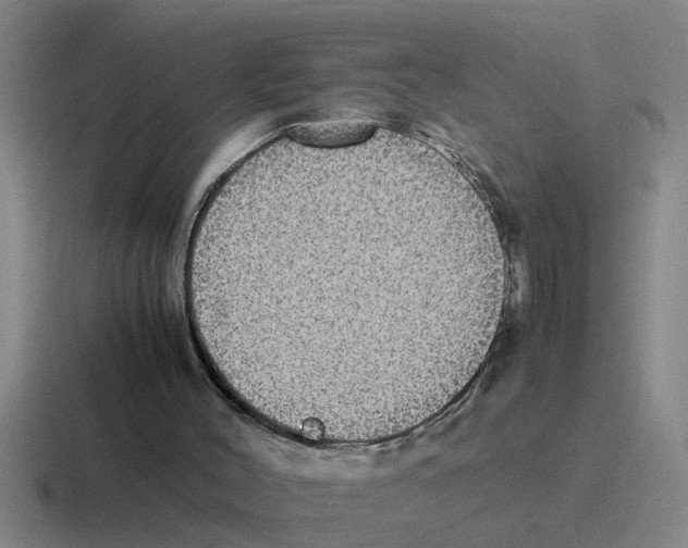 X0000116420004201001051135