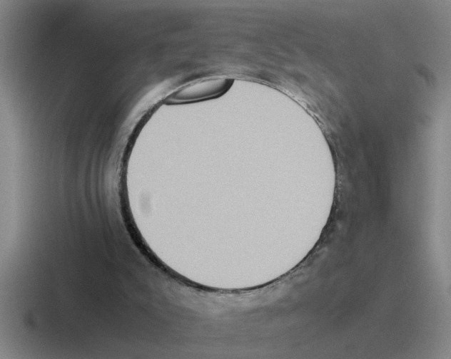X0000116420007201001051135