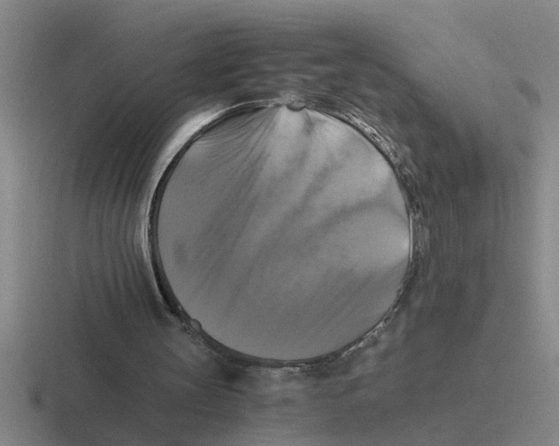 X0000116420147201001051132