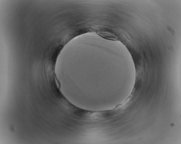 X0000116420186201001051133