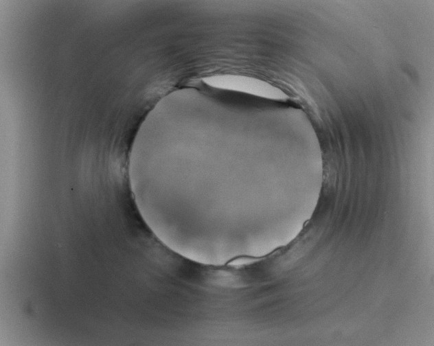 X0000116420285201001051132