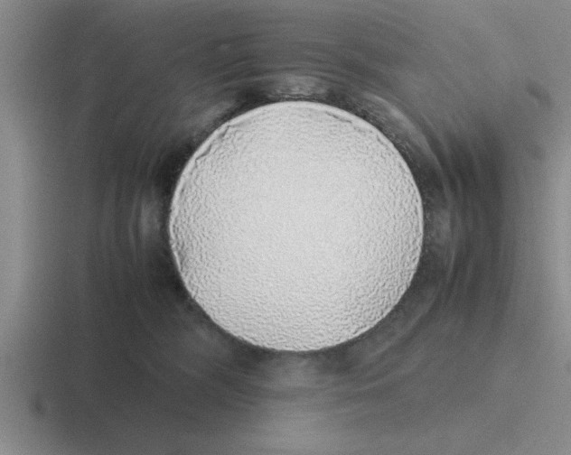X0000116420326201001051131