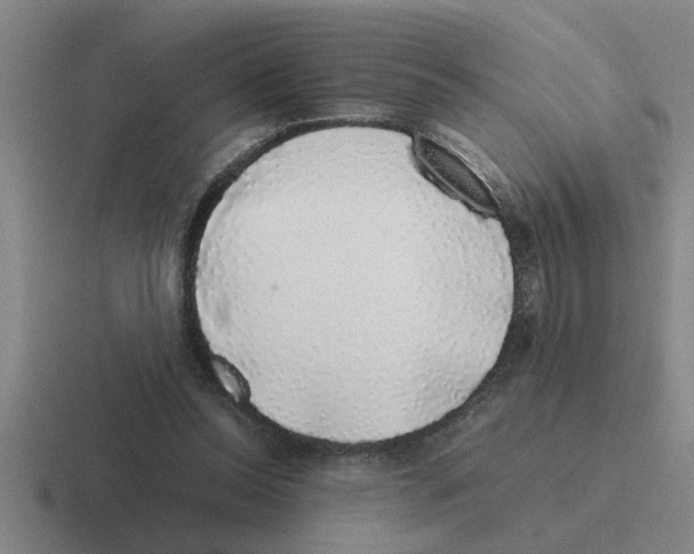 X0000116420350201001051130