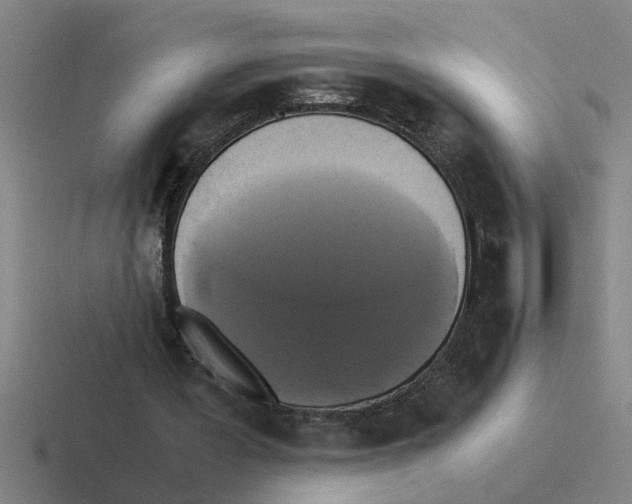 X0000116420387201001051130