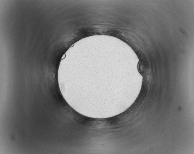 X0000116420615201001051127