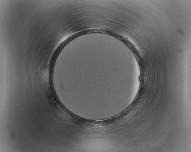 X0000116420975201001051123
